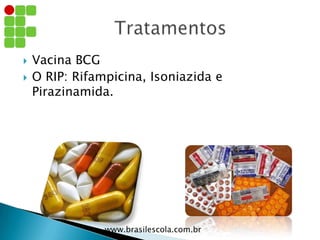  Vacina BCG
 O RIP: Rifampicina, Isoniazida e
Pirazinamida.
www.brasilescola.com.br
 
