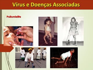 VVíírruuss ee DDooeennççaass AAssssoocciiaaddaass 
PPoolliioommiieelliittee 
 