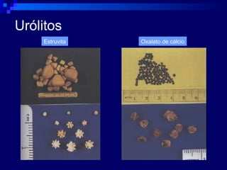 Urólitos Estruvita Oxalato de cálcio 