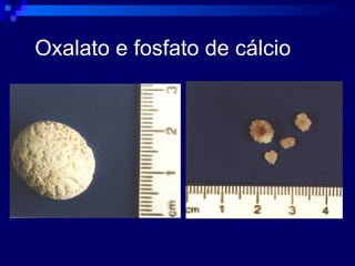 Oxalato e fosfato de cálcio 
