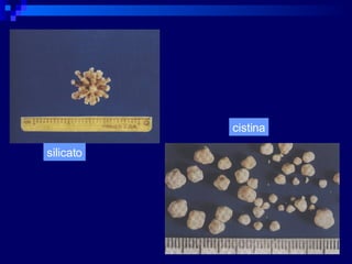cistina silicato 