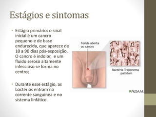 Estágios e sintomas
• Estágio primário: o sinal
inicial é um cancro
pequeno e de base
endurecida, que aparece de
10 a 90 dias pós-exposição.
O cancro é indolor, e um
fluido seroso altamente
infeccioso se forma no
centro;
• Durante esse estágio, as
bactérias entram na
corrente sanguínea e no
sistema linfático.
 