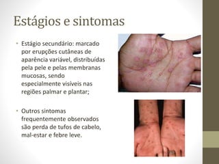 Estágios e sintomas
• Estágio secundário: marcado
por erupções cutâneas de
aparência variável, distribuídas
pela pele e pelas membranas
mucosas, sendo
especialmente visíveis nas
regiões palmar e plantar;
• Outros sintomas
frequentemente observados
são perda de tufos de cabelo,
mal-estar e febre leve.
 