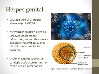 Herpes genital
• Causada pelo vírus herpes
simples tipo 2 (HSV-2);
• As vesículas características da
doença contêm fluidos
infecciosos, mas muitas vezes a
doença é transmitida quando
não há sintoma ou lesão
aparente;
• O sêmen contém o vírus. O
contágio pode ocorrer mesmo
com o uso do preservativo.
 