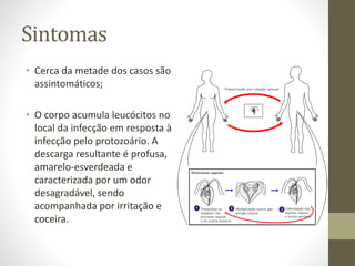 Sintomas
• Cerca da metade dos casos são
assintomáticos;
• O corpo acumula leucócitos no
local da infecção em resposta à
infecção pelo protozoário. A
descarga resultante é profusa,
amarelo-esverdeada e
caracterizada por um odor
desagradável, sendo
acompanhada por irritação e
coceira.
 