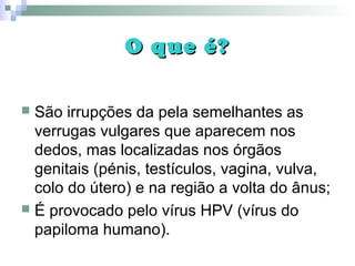 O que é?O que é?
 São irrupções da pela semelhantes as
verrugas vulgares que aparecem nos
dedos, mas localizadas nos órgãos
genitais (pénis, testículos, vagina, vulva,
colo do útero) e na região a volta do ânus;
 É provocado pelo vírus HPV (vírus do
papiloma humano).
 