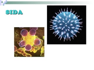 SIDASIDA
 