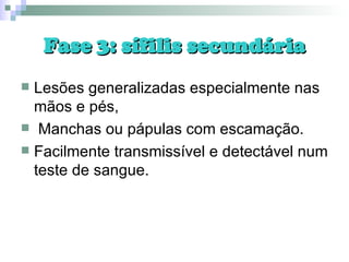 Fase 3: sífilis secundária Lesões generalizadas especialmente nas mãos e pés, Manchas ou pápulas com escamação. Facilmente transmissível e detectável num teste de sangue. 