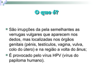 O que é? São irrupções da pela semelhantes as verrugas vulgares que aparecem nos dedos, mas localizadas nos órgãos genitais (pénis, testículos, vagina, vulva, colo do útero) e na região a volta do ânus; É provocado pelo vírus HPV (vírus do papiloma humano). 