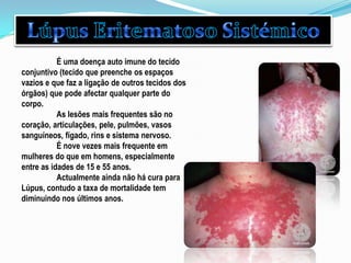 Lúpus Eritematoso Sistémico	É uma doença auto imune do tecido conjuntivo (tecido que preenche os espaços vazios e que faz a ligação de outros tecidos dos órgãos) que pode afectar qualquer parte do corpo.As lesões mais frequentes são no coração, articulações, pele, pulmões, vasos sanguíneos, fígado, rins e sistema nervoso. É nove vezes mais frequente em mulheres do que em homens, especialmente entre as idades de 15 e 55 anos.Actualmente ainda não há cura para Lúpus, contudo a taxa de mortalidade tem diminuindo nos últimos anos. 