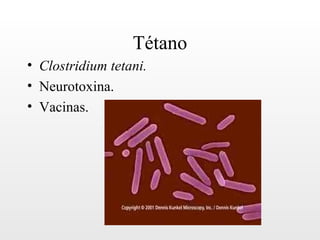 Tétano
• Clostridium tetani.
• Neurotoxina.
• Vacinas.
 