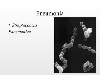 Pneumonia
• Streptococcus
Pneumoniae
 