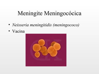 Meningite Meningocócica
• Neisseria meningitidis (meningococo)
• Vacina
 