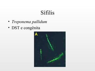 Sífilis
• Treponema pallidum
• DST e congênita
 