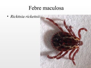Febre maculosa
• Rickttsia rickettsii
 