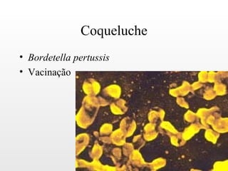 Coqueluche
• Bordetella pertussis
• Vacinação
 