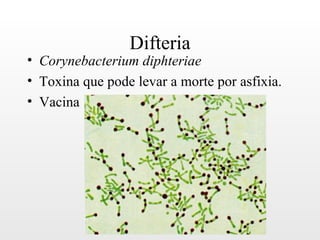 Difteria
• Corynebacterium diphteriae
• Toxina que pode levar a morte por asfixia.
• Vacina
 