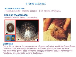 6. FEBRE MACULOSA
AGENTE CAUSADOR:
Rickettsia rickettsii – Bactéria especial – é um parasita intracelular.
MODO DE TRANSMISSÃO:
Ocorre através da picada do carrapato.
SINTOMAS:
Febre, dor de cabeça, dores musculares, náuseas e vômitos. Manifestações cutâneas
Como manchas (máculas) avermelhadas, membros, palma das mãos e tronco.
Nos casos mais graves pode ocorrer na cabeça provocando pápulas hemorrágicas
Resultando em inflamação e morte dos tecidos.
 