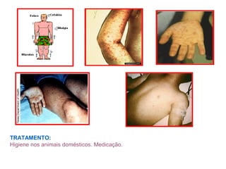 TRATAMENTO:
Higiene nos animais domésticos. Medicação.
 