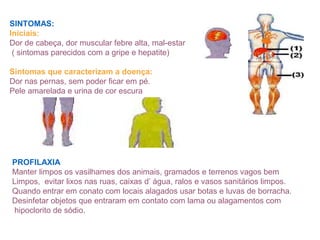 SINTOMAS:
Iniciais:
Dor de cabeça, dor muscular febre alta, mal-estar
( sintomas parecidos com a gripe e hepatite)
Sintomas que caracterizam a doença:
Dor nas pernas, sem poder ficar em pé.
Pele amarelada e urina de cor escura
PROFILAXIA
Manter limpos os vasilhames dos animais, gramados e terrenos vagos bem
Limpos, evitar lixos nas ruas, caixas d’ água, ralos e vasos sanitários limpos.
Quando entrar em conato com locais alagados usar botas e luvas de borracha.
Desinfetar objetos que entraram em contato com lama ou alagamentos com
hipoclorito de sódio.
 