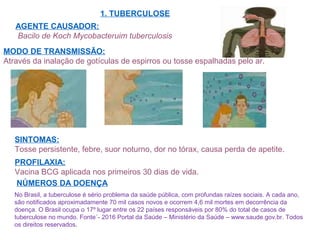 1. TUBERCULOSE
MODO DE TRANSMISSÃO:
Através da inalação de gotículas de espirros ou tosse espalhadas pelo ar.
AGENTE CAUSADOR:
Bacilo de Koch Mycobacteruim tuberculosis
SINTOMAS:
Tosse persistente, febre, suor noturno, dor no tórax, causa perda de apetite.
PROFILAXIA:
Vacina BCG aplicada nos primeiros 30 dias de vida.
NÚMEROS DA DOENÇA
No Brasil, a tuberculose é sério problema da saúde pública, com profundas raízes sociais. A cada ano,
são notificados aproximadamente 70 mil casos novos e ocorrem 4,6 mil mortes em decorrência da
doença. O Brasil ocupa o 17º lugar entre os 22 países responsáveis por 80% do total de casos de
tuberculose no mundo. Fonte´- 2016 Portal da Saúde – Ministério da Saúde – www.saude.gov.br. Todos
os direitos reservados.
 