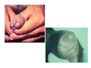 Doenças bacterianas