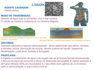 2. CÓLERA
AGENTE CAUSADOR:
Vibrião colare
MODO DE TRANSMISSÃO:
Através de água suja ou alimentos crus e mal cozidos.
O vibrião se instala e multiplica-se no intestino delgado.
SINTOMAS:
Diarréria volumosa e aquosa esbranquiçada ; dores abdominais tipo cólica; náuseas
e vômitos; anúria: diminuição da micção, devido à perda de liquido; hipotermia
desidratação ( pele seca, azulada e enrugada)
PROFILAXIA:
A higiene e o tratamento da água e do esgoto são as principais formas de prevenção.
A fervura da água de consumo é eficaz na destruição da bactéria. A vacina existente é
de baixa eficácia (50% de imunização) e o seu efeito dura apenas de 3 a 6 meses
após a administração, o que a torna inviável.
O vibrião colérico se esconde em água doce, do rio, por duas
semanas , no mínimo.
Na água do mar, o bacilo permanece vivo durante um ano.
 