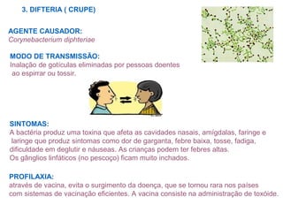 3. DIFTERIA ( CRUPE)
AGENTE CAUSADOR:
Corynebacterium diphteriae
MODO DE TRANSMISSÃO:
Inalação de gotículas eliminadas por pessoas doentes
ao espirrar ou tossir.
SINTOMAS:
A bactéria produz uma toxina que afeta as cavidades nasais, amígdalas, faringe e
laringe que produz sintomas como dor de garganta, febre baixa, tosse, fadiga,
dificuldade em deglutir e náuseas. As crianças podem ter febres altas.
Os gânglios linfáticos (no pescoço) ficam muito inchados.
PROFILAXIA:
através de vacina, evita o surgimento da doença, que se tornou rara nos países
com sistemas de vacinação eficientes. A vacina consiste na administração de toxóide.
 