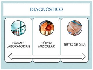 DIAGNÓSTICO
EXAMES
LABORATORIAIS
BIÓPSIA
MUSCULAR
TESTES DE DNA
 
