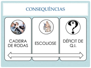 CONSEQUÊNCIAS
CADEIRA
DE RODAS
ESCOLIOSE
DÉFICIT DE
Q.I.
 