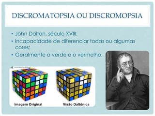 DISCROMATOPSIA OU DISCROMOPSIA
• John Dalton, século XVIII;
• Incapacidade de diferenciar todas ou algumas
cores;
• Geralmente o verde e o vermelho.
 
