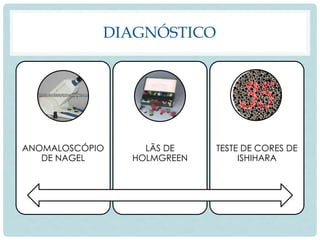 DIAGNÓSTICO
ANOMALOSCÓPIO
DE NAGEL
LÃS DE
HOLMGREEN
TESTE DE CORES DE
ISHIHARA
 