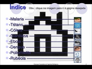 Índice  Obs.: clique na imagem para ir à página desejada  -Malaria ------------------------------------- -Tétano ------------------------------------- -Cólera --------------------------------------- -Giardíase ---------------------------------- -Ebola ---------------------------------------- -Dengue -------------------------------------- -Poliomielite ---------------------------------- -Rubéola -----------------------------------  Doenças Causadas por Agentes Biológicos 