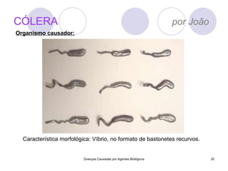 CÓLERA   por João Doenças Causadas por Agentes Biológicos Característica morfológica: Víbrio, no formato de bastonetes recurvos.  Organismo causador: 