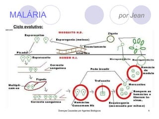 MALÁRIA  por Jean Doenças Causadas por Agentes Biológicos Ciclo evolutivo: 