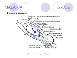 MALÁRIA  por Jean Doenças Causadas por Agentes Biológicos Organismo   causador: 