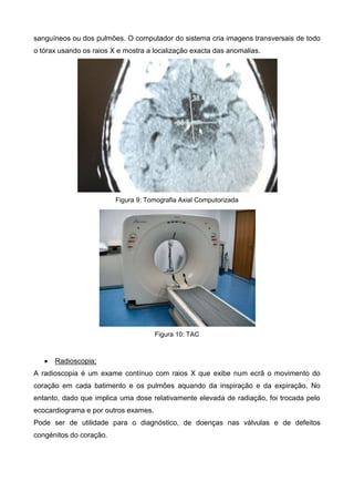 doen-as-cardio-respirat-rias-e-actividade-f-sica-docx