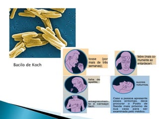 Bacilo de Koch
 