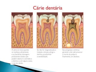 Doenças Causadas Por Bactérias