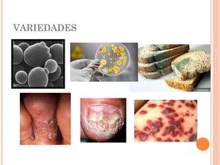 VARIEDADES 