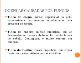 DOENÇAS CAUSADAS POR FUNGOS Tinea do corpo : micose superficial da pele, caracterizada por machas arredondadas com presença de coceira.  Tinea da cabeça : micose superficial que se desenvolve no couro cabeludo, formando falhas no cabelo. Contagiosa, é muito comum em crianças.  Tinea da virilha : micose superficial que causa bastante coceira. Atinge pernas e virilhas.  