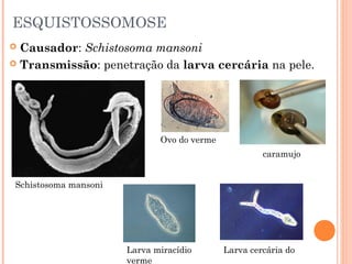 ESQUISTOSSOMOSE
Causador: Schistosoma mansoni
 Transmissão: penetração da larva cercária na pele.


Ovo do verme
caramujo
Schistosoma mansoni

Larva miracídio
verme

Larva cercária do

 