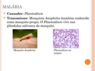 MALÁRIA



Causador: Plasmodium
Transmissor: Mosquisto Anopheles (também conhecido
como mosquito prego). O Plasmodium vive nas
glândulas salivares do mosquito.

Mosquito Anopheles

Plasmodium no
sangue

 