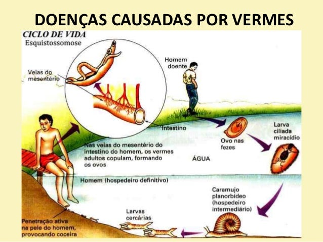 Ifa em um lyambliya em adultos