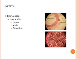 AORTA

   Histologia:
       3 camadas
         Íntima
         Média

         Adventícia
 