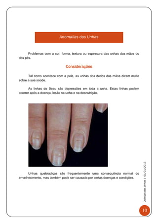 10
DoençasdasUnhas|01/01/2013
Anomalias das Unhas
Problemas com a cor, forma, textura ou espessura das unhas das mãos ou
dos pés.
Considerações
Tal como acontece com a pele, as unhas dos dedos das mãos dizem muito
sobre a sua saúde.
As linhas do Beau são depressões em toda a unha. Estas linhas podem
ocorrer após a doença, lesão na unha e na desnutrição.
Unhas quebradiças são frequentemente uma consequência normal do
envelhecimento, mas também pode ser causada por certas doenças e condições.
 