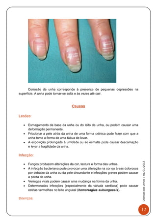 12
DoençasdasUnhas|01/01/2013
Corrosão da unha corresponde à presença de pequenas depressões na
superfície. A unha pode tornar-se solta e às vezes até cair.
Causas
Lesões:
 Esmagamento da base da unha ou do leito da unha, ou podem causar uma
deformação permanente.
 Friccionar a pele atrás da unha de uma forma crônica pode fazer com que a
unha tome a forma de uma tábua de lavar.
 A exposição prolongada à umidade ou ao esmalte pode causar descamação
e levar a fragilidade da unha.
Infecção:
 Fungos produzem alterações da cor, textura e forma das unhas.
 A infecção bacteriana pode provocar uma alteração na cor ou áreas dolorosas
por debaixo da unha ou da pele circundante e infecções graves podem causar
a perda da unha.
 Verrugas virais podem causar uma mudança na forma da unha.
 Determinadas infecções (especialmente da válvula cardíaca) pode causar
estrias vermelhas no leito ungueal (hemorragias subungueais).
Doenças:
 