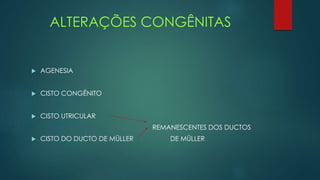 ALTERAÇÕES CONGÊNITAS
 AGENESIA
 CISTO CONGÊNITO
 CISTO UTRICULAR
REMANESCENTES DOS DUCTOS
 CISTO DO DUCTO DE MÜLLER DE MÜLLER
 