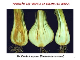 Burkholderia cepacia (Pseudomonas cepacia)
PODRIDÃO BACTERIANA DA ESCAMA DA CEBOLA
61
 