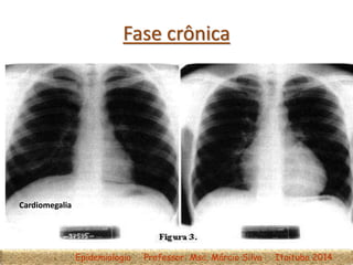 Fase crônica
Epidemiologia Professor: Msc. Márcio Silva Itaituba 2014
Cardiomegalia
 